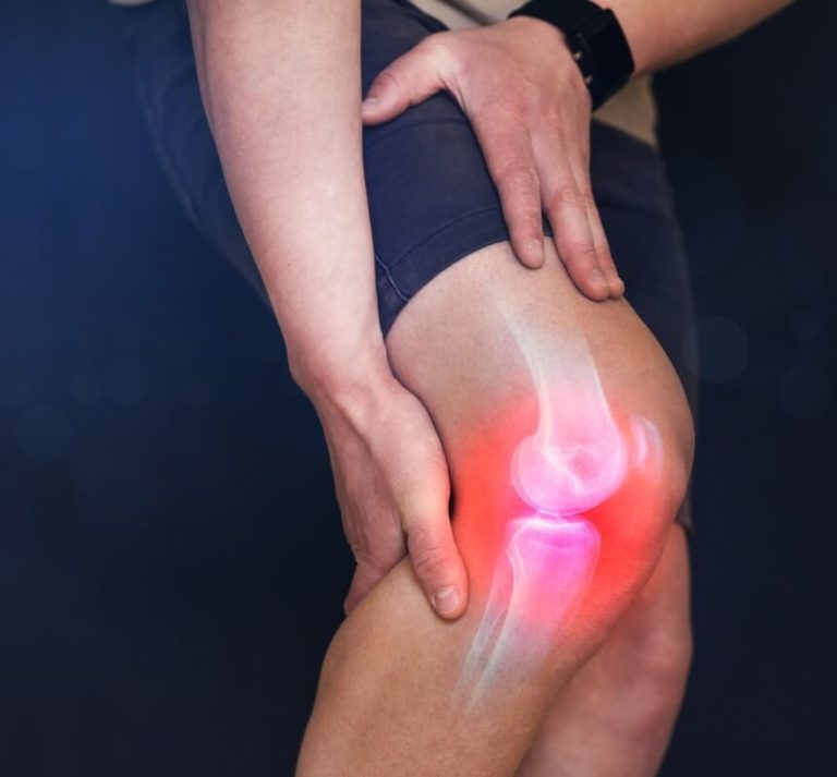 Osteoarthritis Treatment at Sunridge Medical