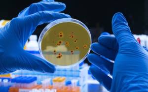 scientist-examines-dengue-virus-on-petri-dish-in-laboratory-conceptual-image