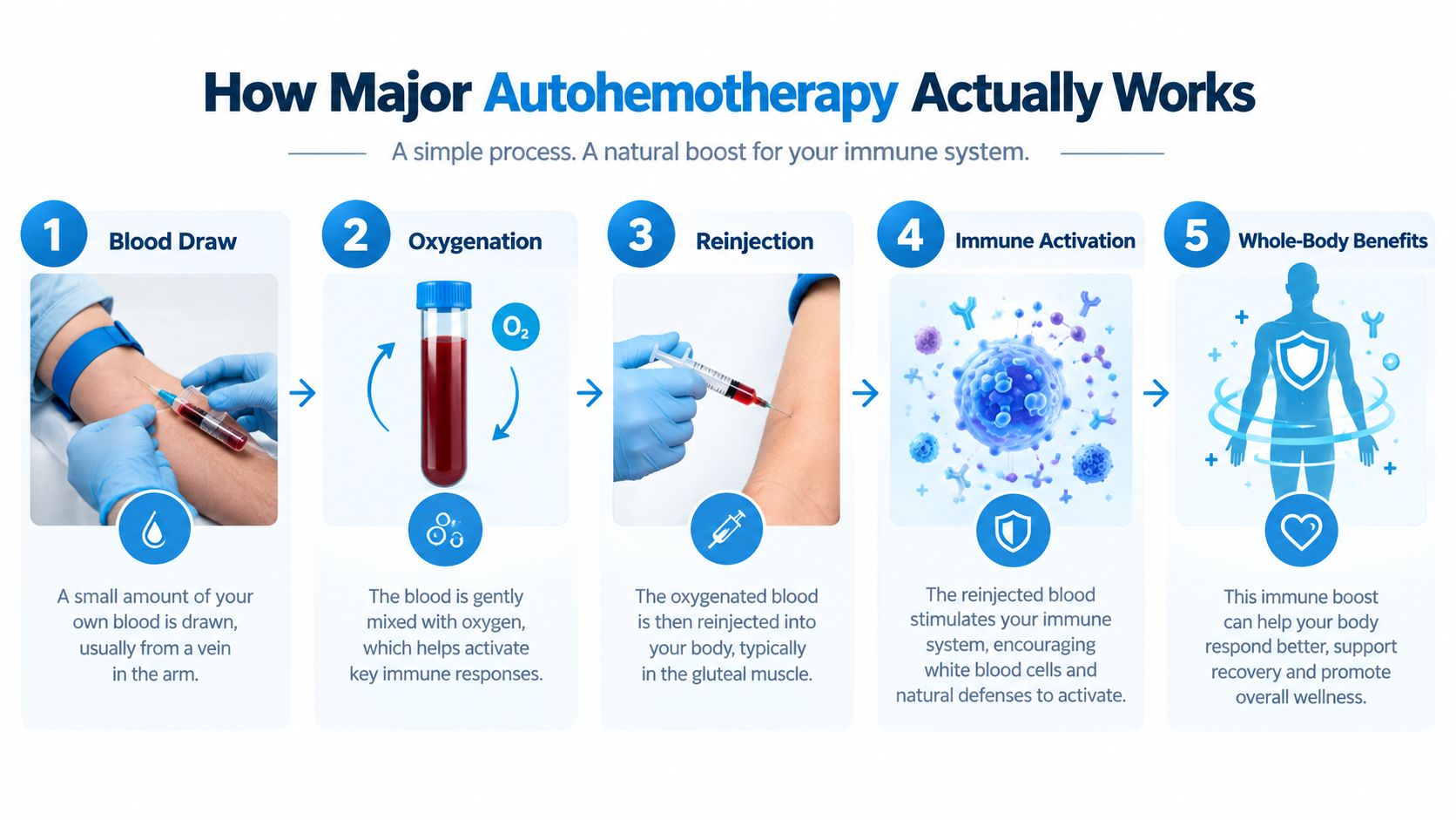 A five-step infographic showing the process of major autohemotherapy, from blood draw to immune activation and wellness benefits.